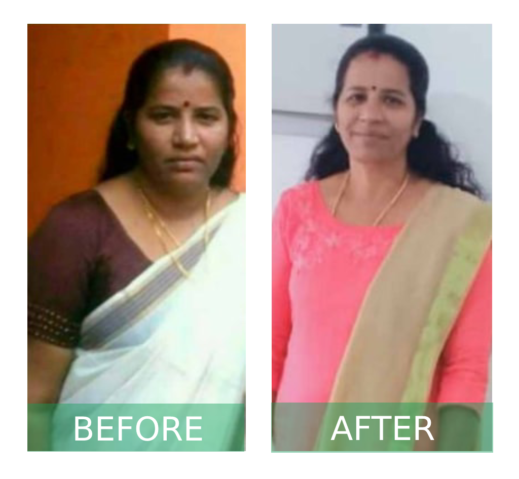 Lost 10 kgs in 45 days